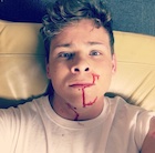 Jonathan Lipnicki : jonathan-lipnicki-1496874115.jpg