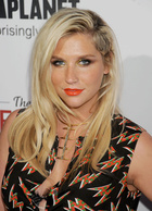 Ke$ha : keha-1409589365.jpg